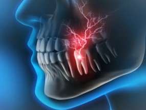 Toothache or Dental Pain