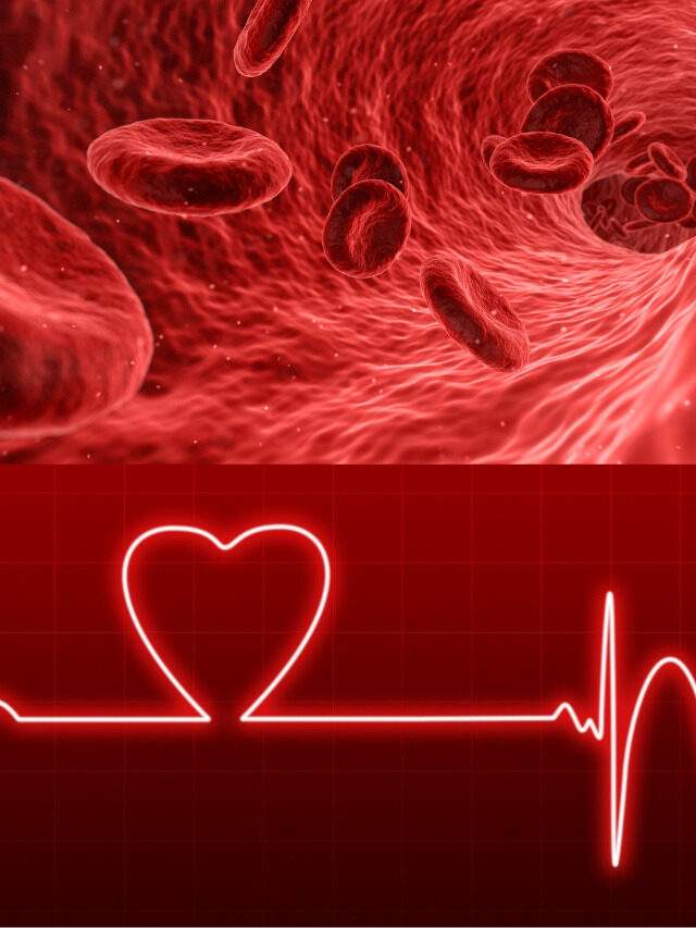 Cause of Anaemia or Anemia