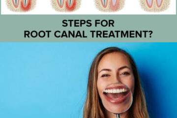 Root Canal Treatment or RCT Indications