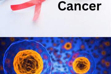 What are Causes & Risk Factor of Cancer
