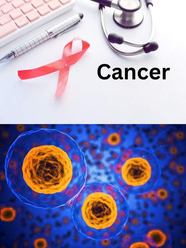 What are Causes & Risk Factor of Cancer